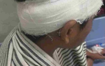 Lagi lagi Kelompok Gangster Beraksi Bak Koboy Seorang Anak Remaja Kena Bacok