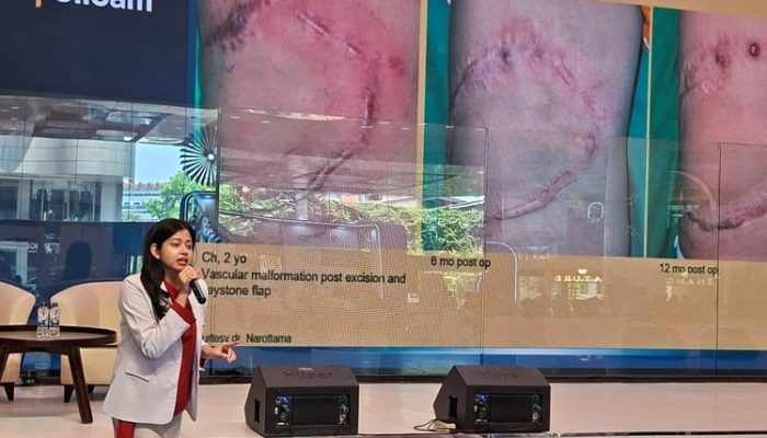 Perdana Bedah Plastik, Rekonstruksi dan Estetik dengan Standar Korea Selatan di Siloam Hospital TB Simatupang