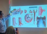 Kecepatan Menjadi Kunci Penyelamatan Nyawa pada Penanganan Penyakit Aorta Kompleks di Era Modern